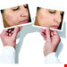  کنترل چربی انواع پوست 30 میل مورد آمریکا Murad Blemish Control InvisiScar Resurfacing Treatment 30 ml