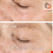 کرم صورت لایه بردار سه گانه فیزیکی شیمیایی آنزیمی Murad - Vita-C Triple Exfoliating Facial 80 ml 